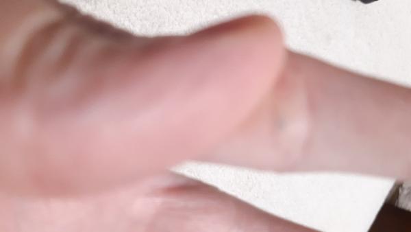 Akú hrčku mám na palci v zhybe?