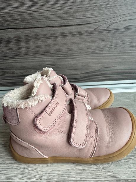 Zimne topanky protetika barefoot, protetika,29