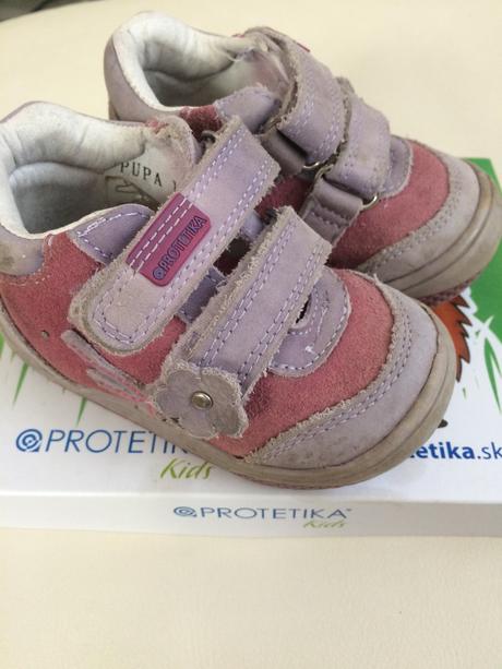 Prechodné topánky protetika, protetika,19