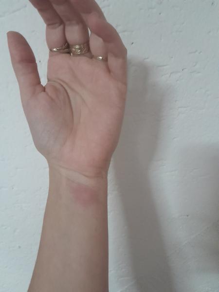 Ako riešiť alergiu na aviváž alebo prací prášok?