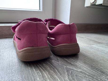 Protetika barefoot sandále, protetika,31