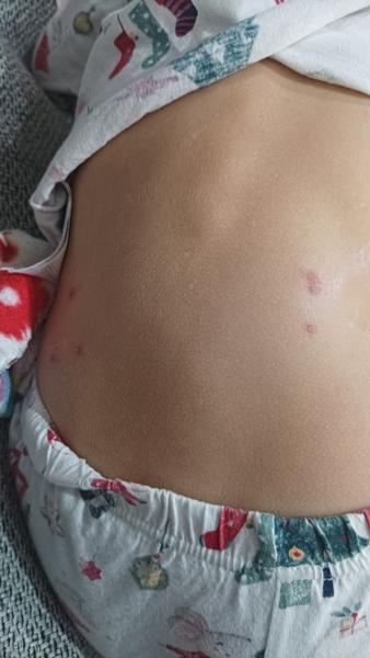 Čo sú to za štípance?