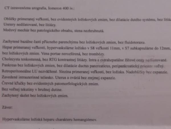 Kto mi vysvetlí výsledky CT vyšetrenia?