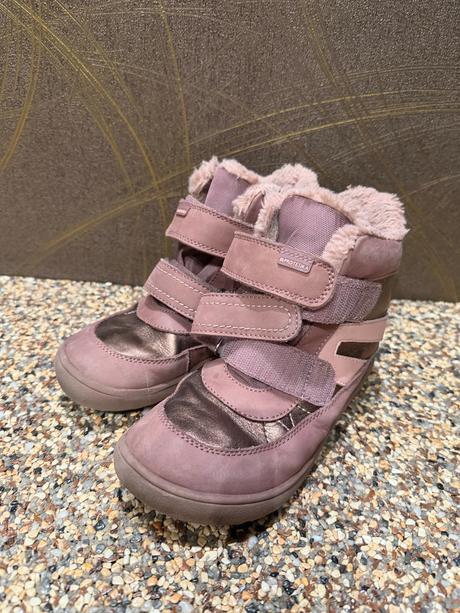 Barefoot zimne topanky ruzove, protetika,33