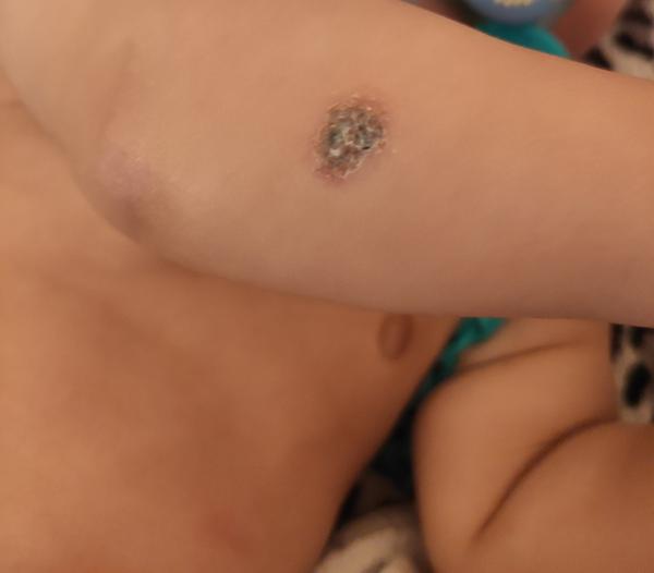 Akú chrastičku to má môj 6 mesačný syn už dva mesiace?