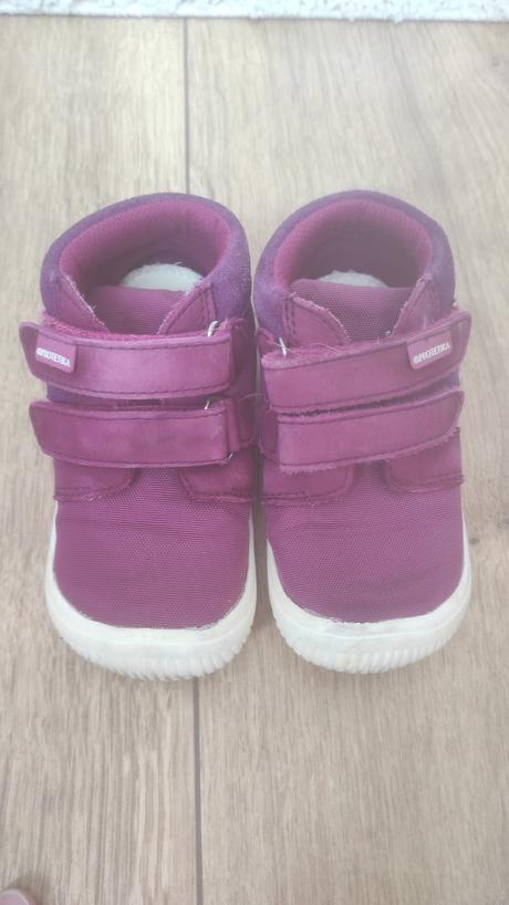 Celoročky protetika, protetika,24