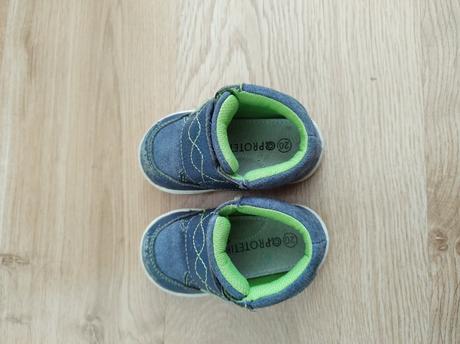 Topánky protetika, protetika,20