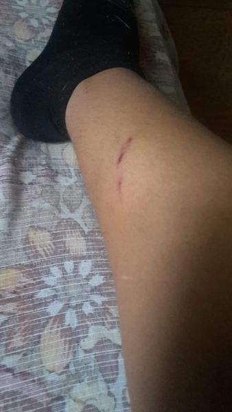 Problémy so susedmi