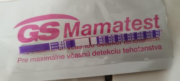 Ako správne interpretovať výsledky moču?