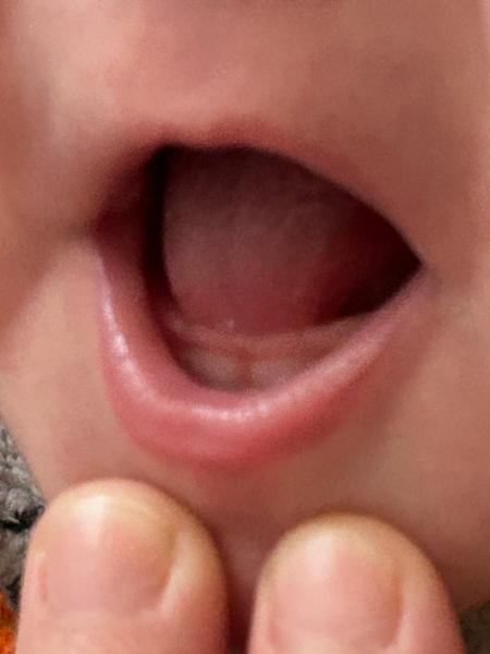 Sú to zúbky? Príznaky rastu a rady pre matky