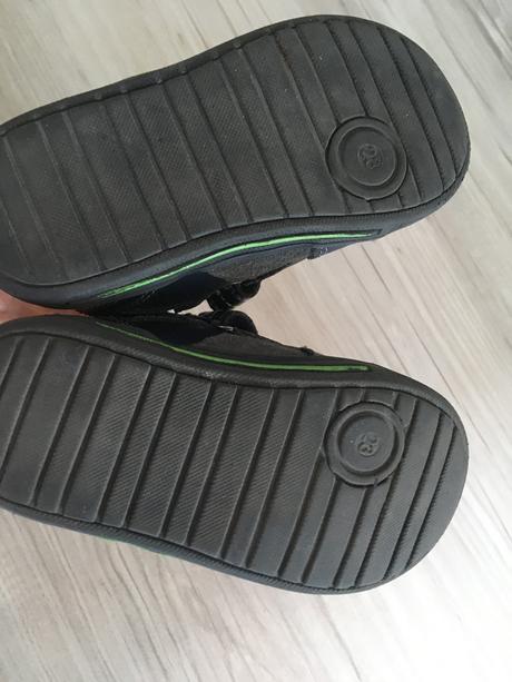 Topanocky protetika, protetika,23