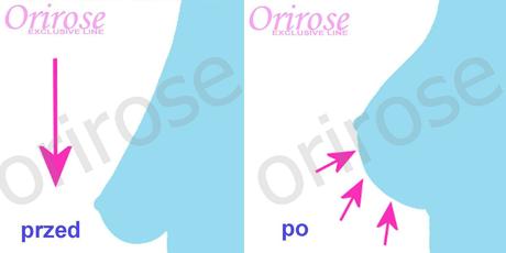 Xtreme bra - revolučný podporný pás na spevnenie, l