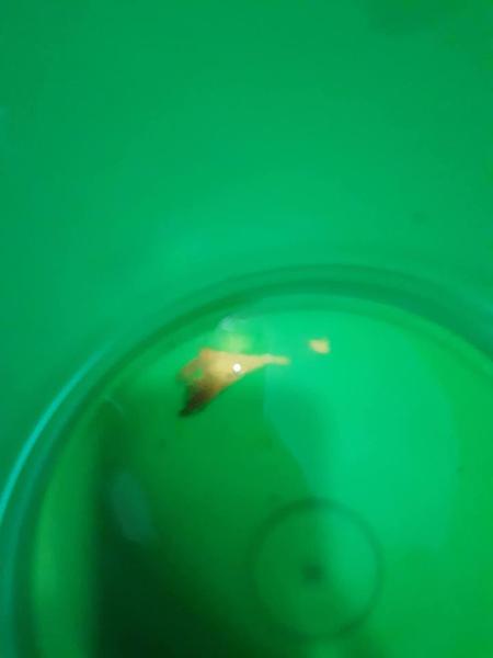 Som v 36. týždni a niečo zo mňa vytieklo