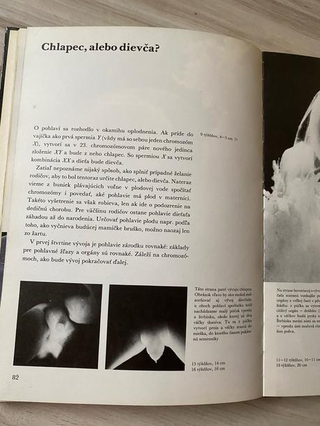 Krásna kniha čakáme dieťatko,