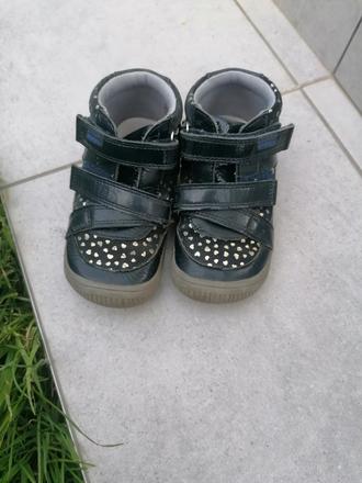 Prechodné protetika, protetika,26