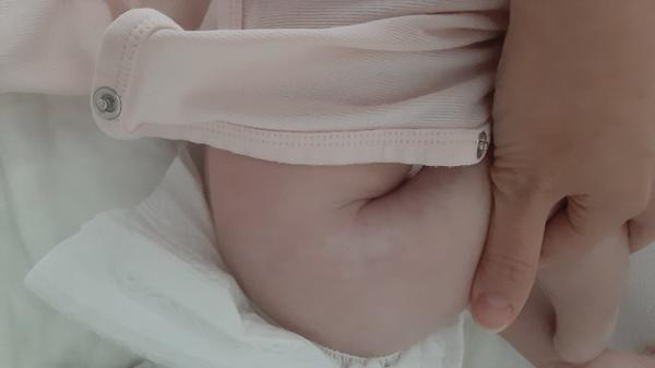 Akú bielu škvrnu má dcérka na nožičke?