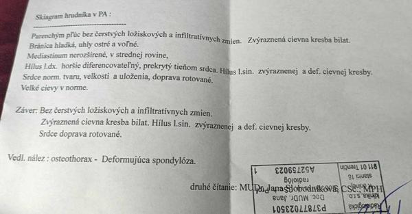 Môžete mi vysvetliť RTG nález pľúc?