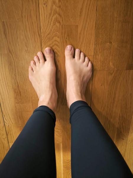 Je to hallux alebo len spadnutá klenba?