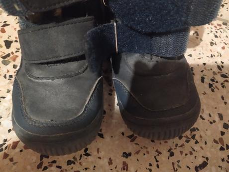 Zimne barefoot protetiky, protetika,27