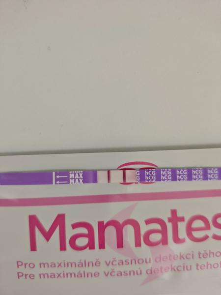 Viditeľnosť tehotenstva v 5. týždni na ultrazvuku?