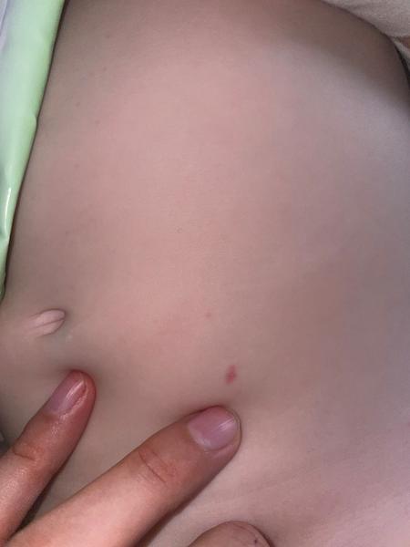 Čo má môj syn na brušku?