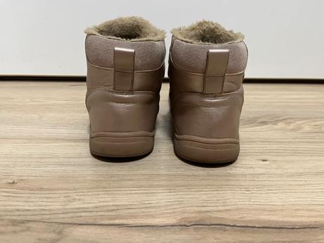 Zimne topanky, protetika,35